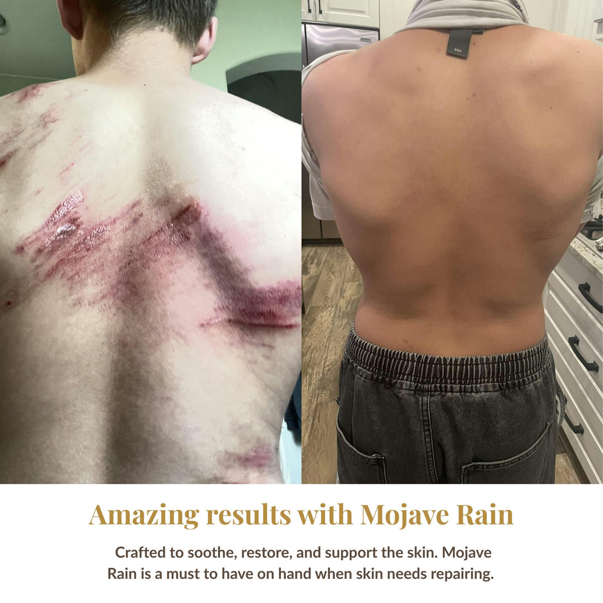 Before and after comparison of a person's back with visible skin issues, showing improvement with Mojave Rain product.